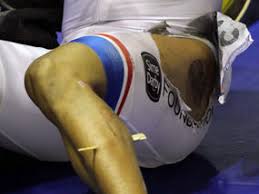 Maybe you would like to learn more about one of these? Big Splinter For Cyclist Sprinter Other Sport Express Co Uk