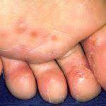 Koltuk Alti Kararmasi Nasil Gecer Pembe Fikirler Koltuk Alti Sac Bakimi Koltuklar