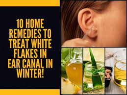 10 Home Remedies To Treat White Flakes In Ear Canal In Winter Dry Flaky Skin Dry Skin Remedies Treating Dry Skin