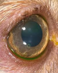 Image result for Eye Foreign Body