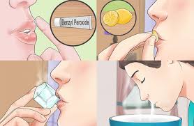 What causes acne on upper lip? Home Remedies To Get Rid Of Lip Pimples Fast Yeyelife