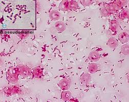 Melioidosis may also remain latent for months or years before symptoms develop. Melioidosis