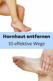 Hornhaut Entfernen Hornhaut Hausmittel Hornhaut Backpulver Hornhaut Hande Hornhaut Aufweichen Hornhaut Fusspflege Hornhaut Entfernen Hornhaut Hausmittel