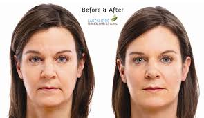 Please book an appointment, and arrive only a few minutes before scheduled time. Lakeshore Vein Aesthetics Clinic Find Private Clinics