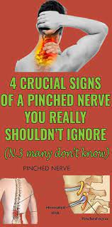 These Are Some Of The More Common Symptoms Of Compressed Nerves Pinched Nerve Nerve Problems Health Info
