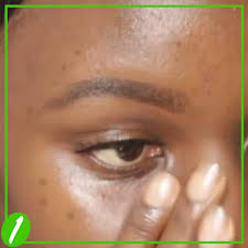 If your skin is hyperpigmented, vitamin c should be one of the first ingredients you integrate into your skincare routine. How To Get Rid Of Hyperpigmentation On Dark Skin