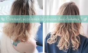 We did not find results for: Accelerer La Pousse Des Cheveux C Est Possible La Coquette Ethique