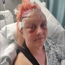 Fundraiser by Shaun Gegan : Fundraiser for Jenna Stevens, Whose Brain  Sabotaged Her