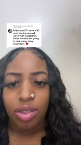 Reply to @sourpatchbarri Any more questions I need To Answer?  #treachercollinssyndrome