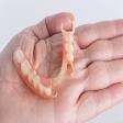 Parital Dentures
