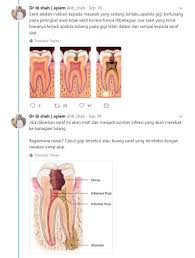 Rawatan scalling tidak memutihkan gigi, ikuti perkongsian doktor ini untuk gigi seputih berlian. Jangan Ambil Remeh Esen Vanila Tak Sembuhkan Sakit Gigi
