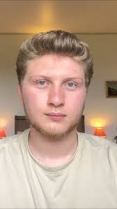 The girl #Fatima Ahmed al-Hassan from Aleppo city She is seven years old  She lost one of her limbs and her father killed in a rocket during the  violentcampaign of the Assad