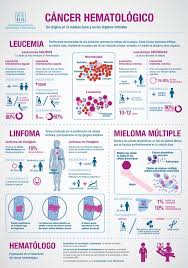 La leucemia colpisce solitamente i globuli bianchi, cellule che hanno lo quando si sviluppa una leucemia il midollo osseo produce grandi quantità di globuli bianchi che non funzionano correttamente. Raul Cordoba Md Phd On Twitter Cancer Hematologico Sehh Es Leucemia Linfoma Mieloma