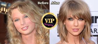 Team taylor swift, profile picture · team taylor swift. Taylor Swift Plastic Surgery News Before And After Plastic Surgery Celebrity Plastic Surgery Cosmetic Surgery