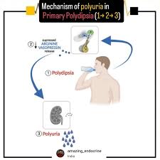 Image result for Polyuria