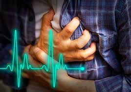 Infarto agudo de miocardio patología caracterizada por la muerte de una porción del músculo cardíaco producida por la obstrucción completa una la fracción de eyección del ventrículo izquierdo (fevi) y el tamaño del infarto agudo de miocardio (iam) tienen limitaciones para estratificar el ries. Infarto Agudo De Miocardio Articulos Intramed