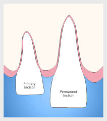 Image result for Tooth Avulsion