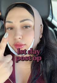 Chin Lipo Recovery: My First Massage Experience