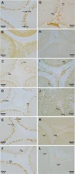 We did not find results for: Vitamin D3 Regulates Apoptosis And Proliferation In The Testis Of D Galactose Induced Aged Rat Model Scientific Reports