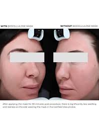 DERMEDEN BIOCELLULOSE: Mặt Nạ Cấp Ẩm & Phục Hồi Chuyên Sâu, Hạn Chế Tăng  Sắc Tố