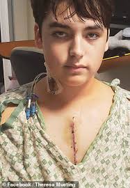 Texas teen lived with a heart defect for 14 YEARS before suffering major  heart attack