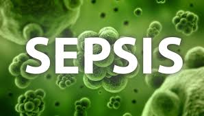 Image result for Sepsis