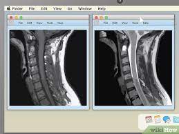 Speak with the imaging department and ask them to describe the format of the cd and ask them for instruction on how to view it, what viewer to use and where such viewer can be found. How To Read An Mri 15 Steps With Pictures Wikihow