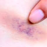 Laser underarm hair removal machines work by sending wavelengths of light to the hair root or follicles. Laser Hair Removal Full Body Laser Hair Removal Clinic In Delhi Ludhiana India