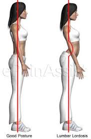 We did not find results for: Lumbar Lordosis Or Lumbar Swayback 5 Simple Corrective Exercises Tips For Prevention Lumbar Lordosis Fitness Tips Scoliosis Exercises