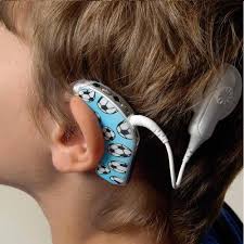 How much does a cochlear implant cost. Cochlear Implants At Best Price In India