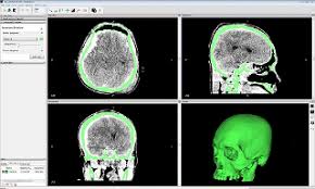 Jump to navigation jump to search. Comparison Of Stl Skull Models Produced Using Open Source Software Versus Commercial Software Emerald Insight
