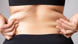 A panniculectomy must meet specific criteria to be medically necessary. Excess Skin Removal Panniculectomy Costhetics
