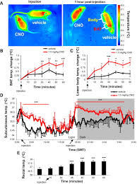 Leptin receptor neurons in the dorsomedial hypothalamus are key regulators  of energy expenditure and body weight, but not food intake
