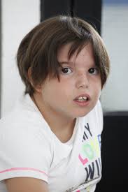 Argonaute Syndromes Web Version for AGO Alliance