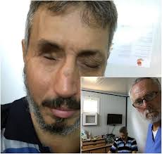 US Pastor Helping Muslim Syrian Expats Care for Refugees in Turkey Says  Many Feel Hopeless