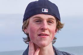 Locals would like to see a hotel developed