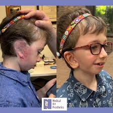 Eye-catching details make our work disappear! 👁️ We work hard to create  symmetry, blended edges, and custom details that are as unique as the  wearer. Reach out to learn more! medicalartprosthetics.com/contact  #anaplastology #