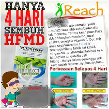 Penyebab henti jantung pada anak dan cara mengatasi. Cara Merawat Penyakit Kaki Tangan Dan Mulut Hfmd Dari Rumah