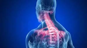 Boyun Fitigi Ve Tedavisi Hemen Saglik