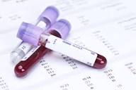 Blood Count Tests: MedlinePlus