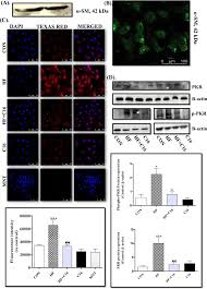 410672909 rpp pkr kelompok 8 211 docx Selective Inhibition Of Pkr Improves Vascular Inflammation And Remodelling In High Fructose Treated Primary Vascular Smooth Muscle Cells Sciencedirect