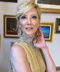 Causa da morte da atriz Anne Heche é divulgada