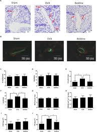 My boldine arrived after days, and was left at room temperature. Frontiers Boldine Ameliorates Estrogen Deficiency Induced Bone Loss Via Inhibiting Bone Resorption Pharmacology