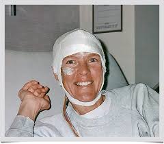 Fixing Diane's Brain