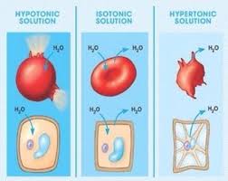 What Occurs To A Cell With Hypo Iso And Hypertonic Solutions Nursing School Survival Nurse Nursing School Tips