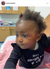 Petition · We Need Accountability for What Happened to Brie! Close Tiny T's  Child Care!