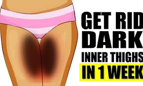 Dark Skin On The Inner Thighs Is An Embarrassing Issue For Both Men And Women This Problem Even Affects People Who Dark Spots On Skin Skin Spots Lighten Skin