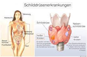 Geheimnisvolle Schilddruse 100 Symptome 1 Ursache