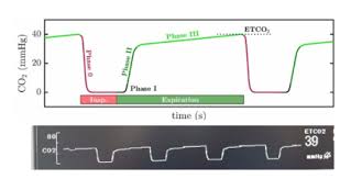 Image result for End-Tidal O2