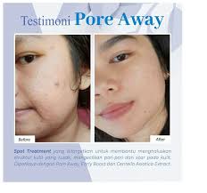 TERLARIS PORE AWAY MS GLOW 1 PCS